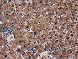 ADH2 / ADH1B Antibody (clone OTI4F12)