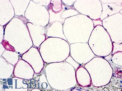 PathPlus™ C5AR2 / GPR77 / C5L2 Antibody (Extracellular Domain)