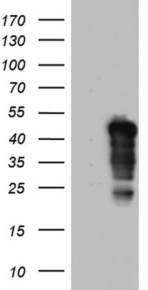 Monoclonal Mouse anti-Human NRBF2 Antibody (clone OTI1D1, WB)
