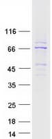 Human CAMKV Protein (Recombinant Myc-DDK (Flag))