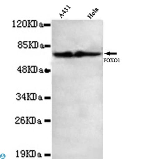FOXO1 / FKHR Antibody