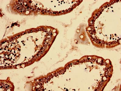 LBA / LRBA Antibody
