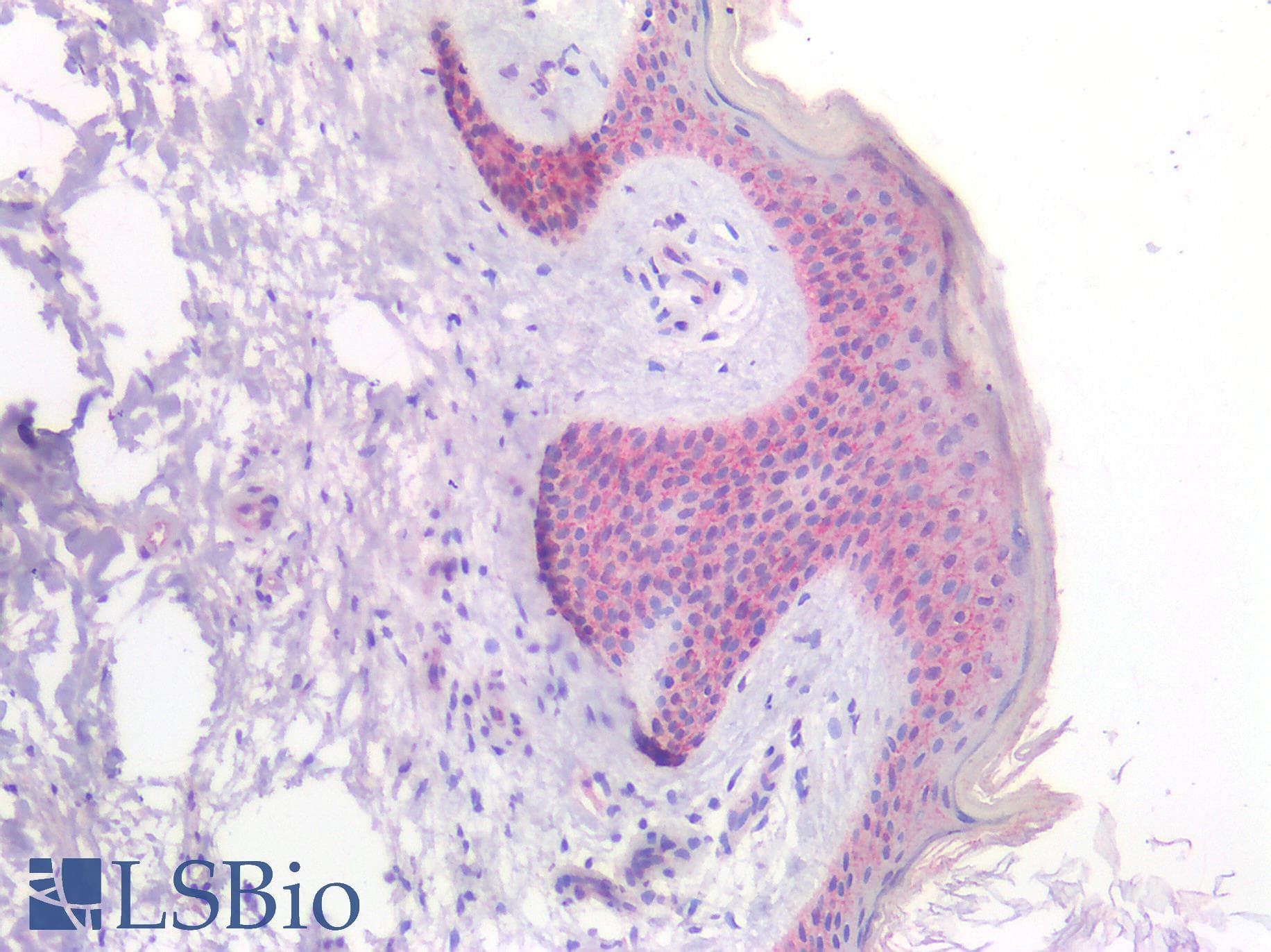 PathPlus™ CTNNB1 / Beta Catenin Antibody