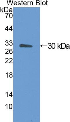 ANGPTL4 Antibody (aa182-394, Biotin)