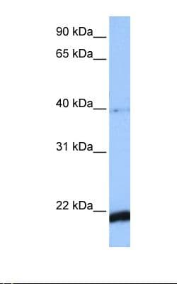 HBS1L Antibody (N-Terminus, Biotin)