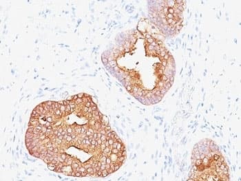KLK3 / PSA Antibody (clone 1A7 or 1A7G6B6)