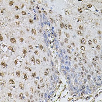 CCNA2 / Cyclin A2 Antibody
