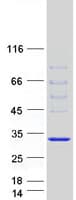 Human DNAJB6 Protein (Recombinant Myc-DDK (Flag))