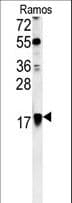ARF1 Antibody (aa80-106)