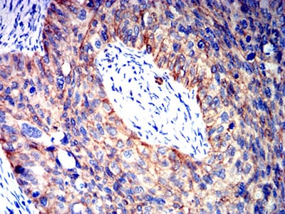 CTNNB1 / Beta Catenin Antibody (clone 7C5A2)