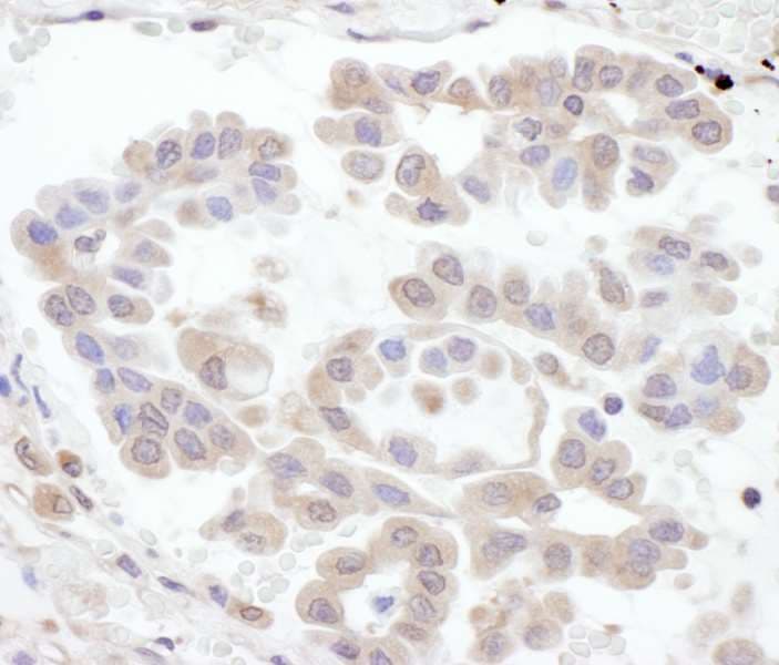 RABGEF1 Antibody (aa175-225)