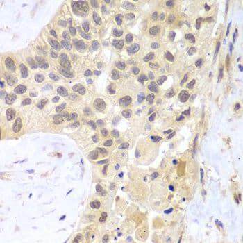 Polyclonal Rabbit anti-Human PSMC5 / SUG1 Antibody (IHC, WB)