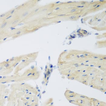 P3H3 / LEPREL2 Antibody