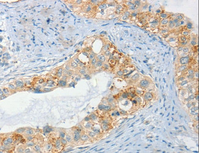Polyclonal Rabbit anti-Human AANAT Antibody (IHC)
