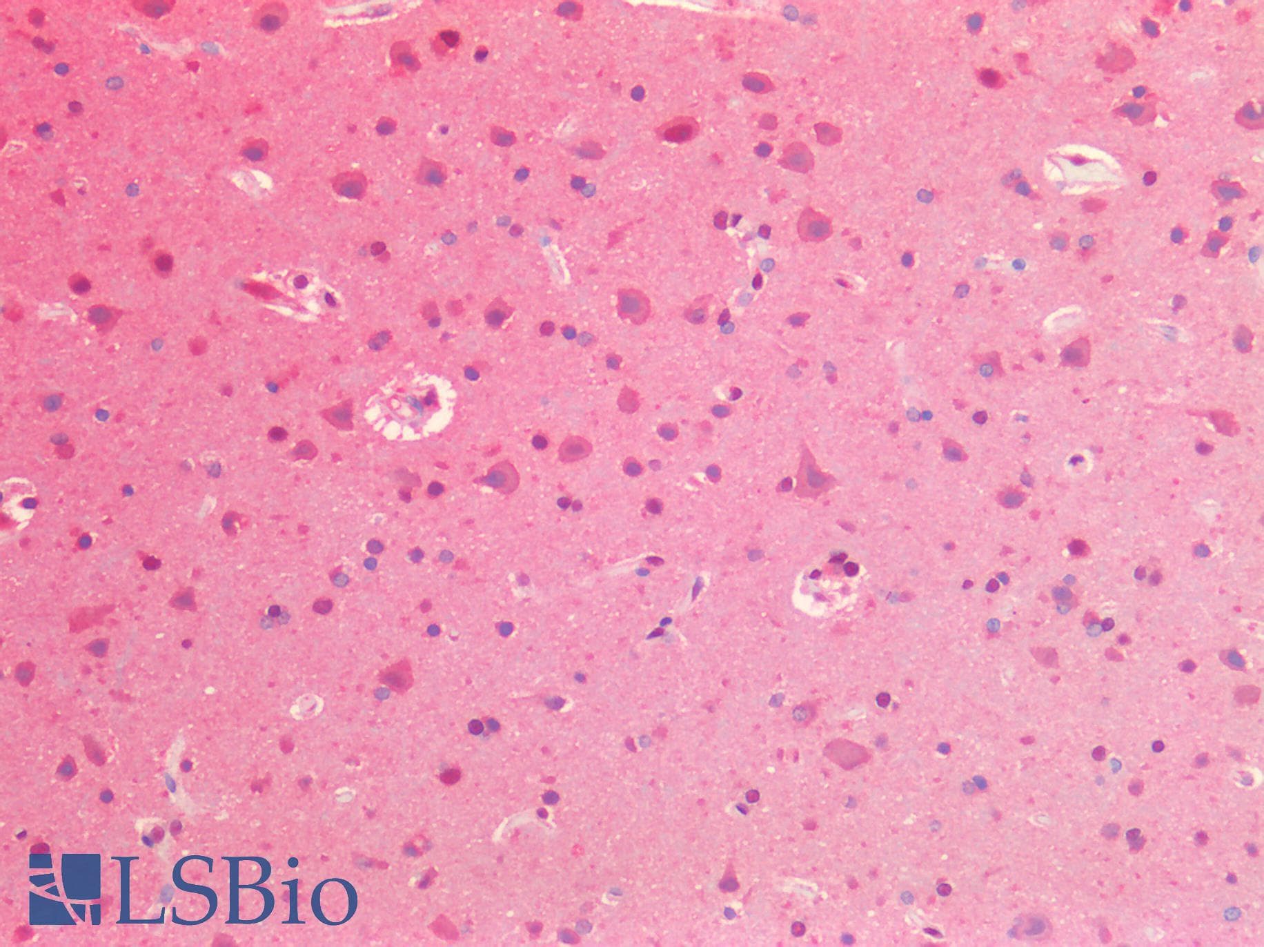 IHC-plus™ VCP Antibody (Internal Region)