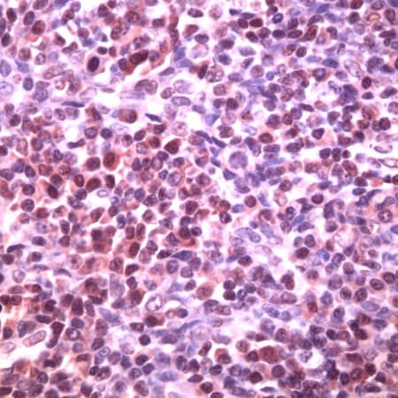 BCL6 Antibody (Internal)