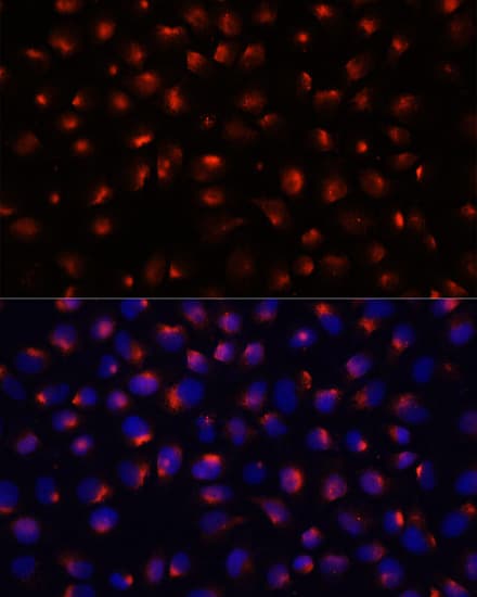 Polyclonal Rabbit anti-Human ACTN3 Antibody (IF, WB)