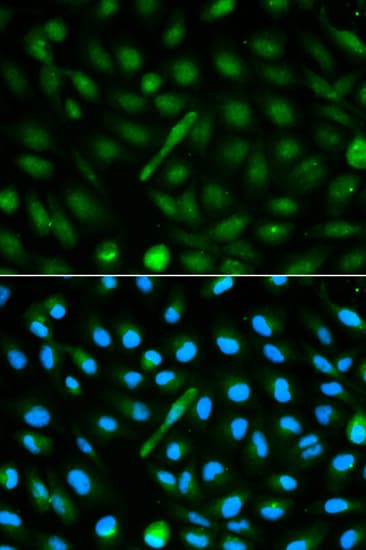 Polyclonal Rabbit anti-Human AHSG / Fetuin A Antibody (IHC, IF, WB)