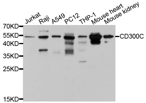 Polyclonal Rabbit anti-Human CD300C Antibody (WB)