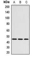 SERPINA6 / CBG Antibody