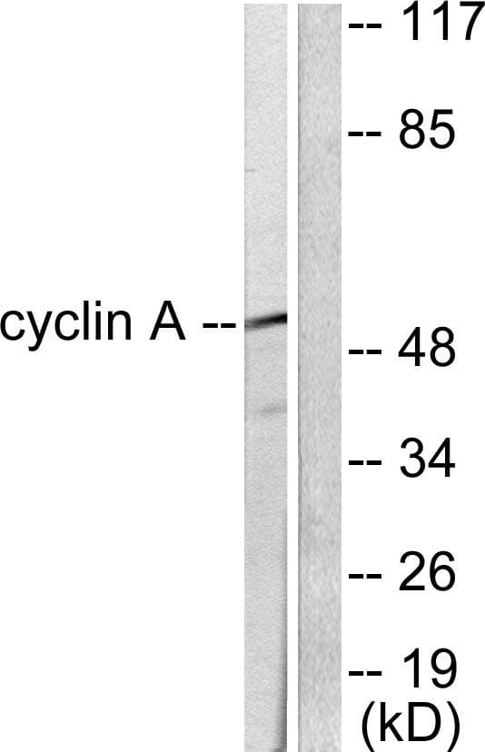 CCNA1 / Cyclin A1 Antibody