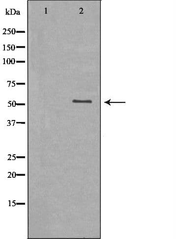DLD / Diaphorase / E3 Antibody