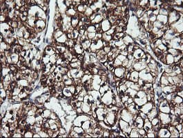 ACAA2 Antibody (clone OTI2H2)
