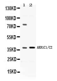 BABP / AKR1C2 Antibody