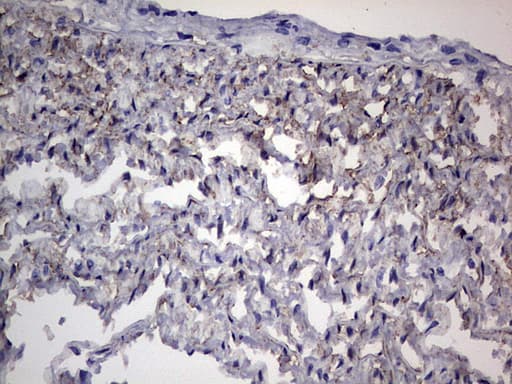 Monoclonal Mouse anti-Human Adiponectin Antibody (clone OTI6B8, aa19-244, IHC, WB)