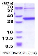 Human NXPH1 Protein (Recombinant His)