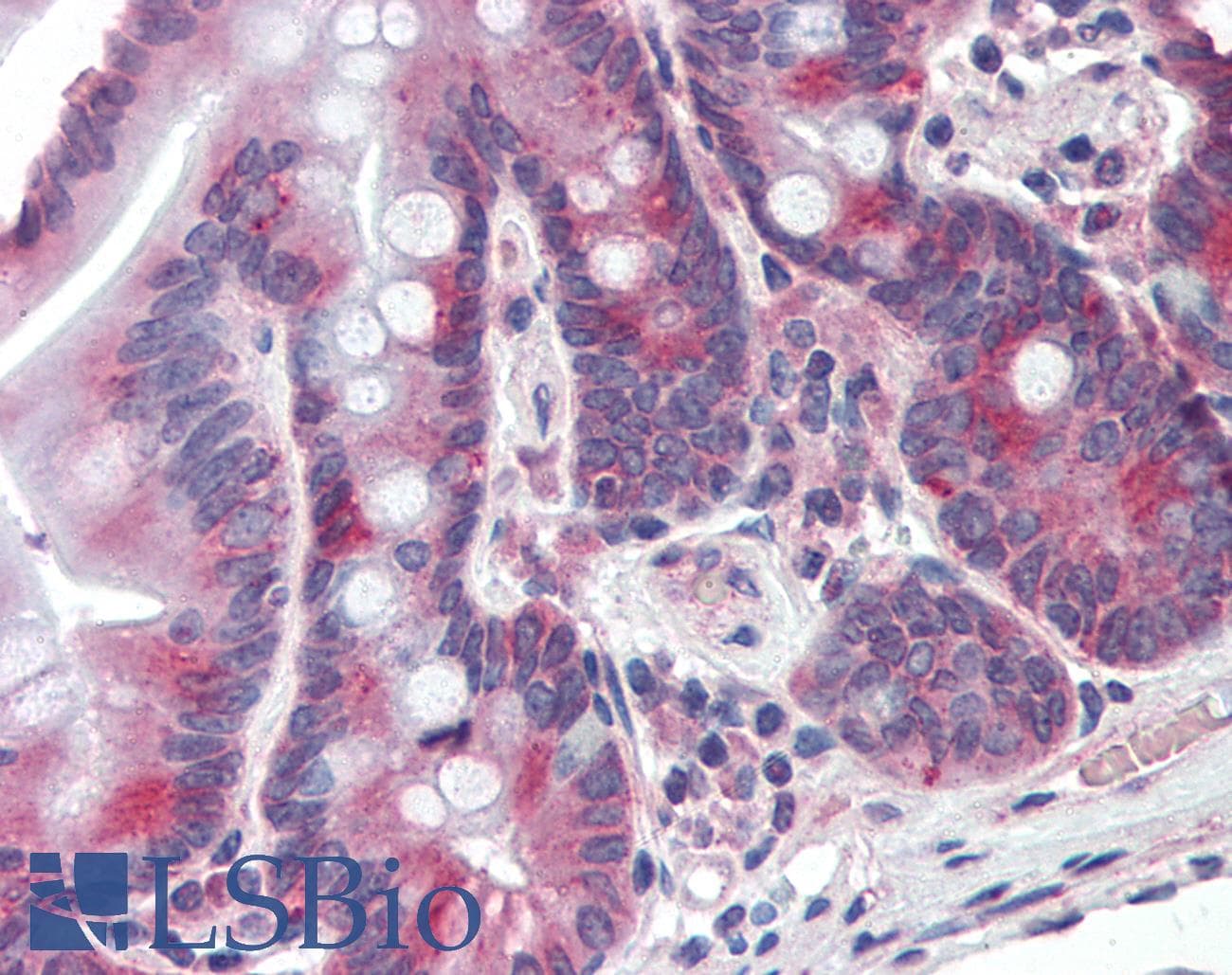 IHC-plus™ PIGR Antibody (Extracellular Domain)