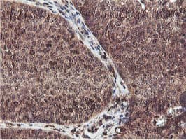 EPN2 Antibody (clone OTI1G3, Carrier-free)