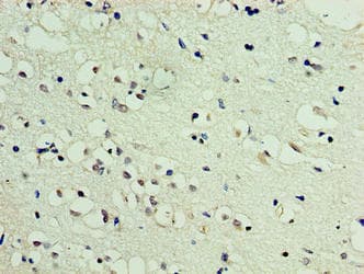 DBNDD2 Antibody (aa1-161)