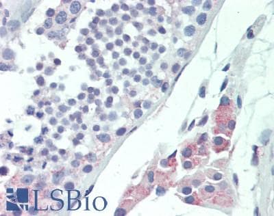MLF1 Antibody (aa215-244)
