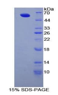 Human FBN1 / Fibrillin 1 Protein (Recombinant His-GST)