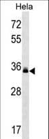 LMAN2 / VIP36 Antibody (aa285-314)