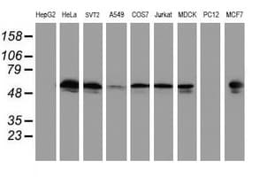 TUBAL3 Antibody (clone OTI3B7)