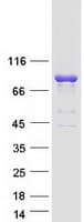 Human ARHGEF7 Protein (Recombinant Myc-DDK (Flag))