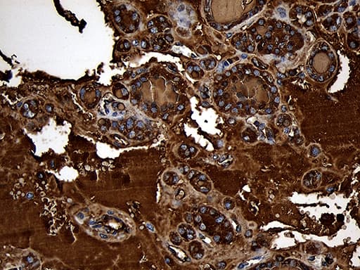 TG / Thyroglobulin Antibody (aa20-358, clone OTI8E1)