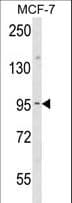 Polyclonal Rabbit anti-Human JUP/CTNNG/Junction Plakoglobin Antibody (aa636-663, IHC, WB)