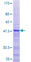 Human ZNF385C Protein (Recombinant GST)