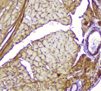 Polyclonal Rabbit anti-Human CKM / Creatine Kinase MM Antibody (IHC, WB)