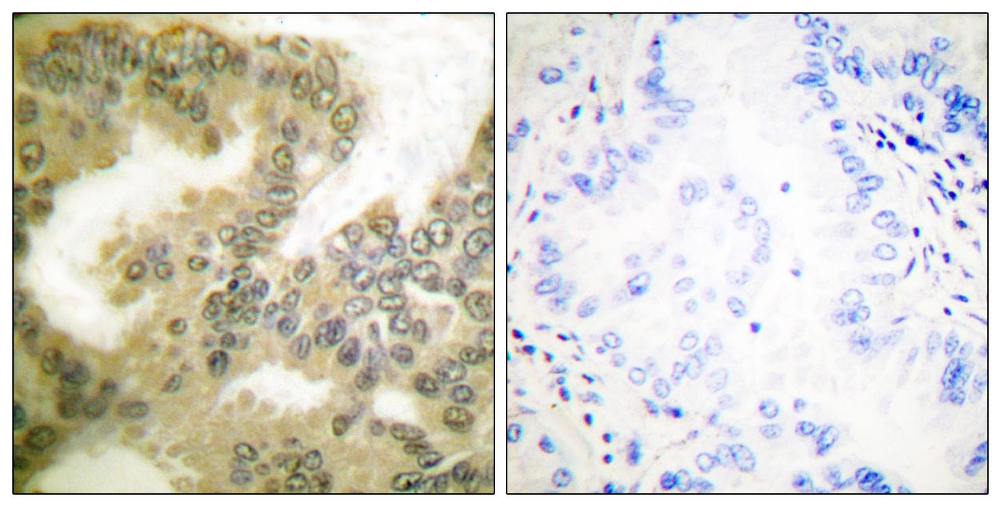 CCND3 / Cyclin D3 Antibody (phospho-Thr283)