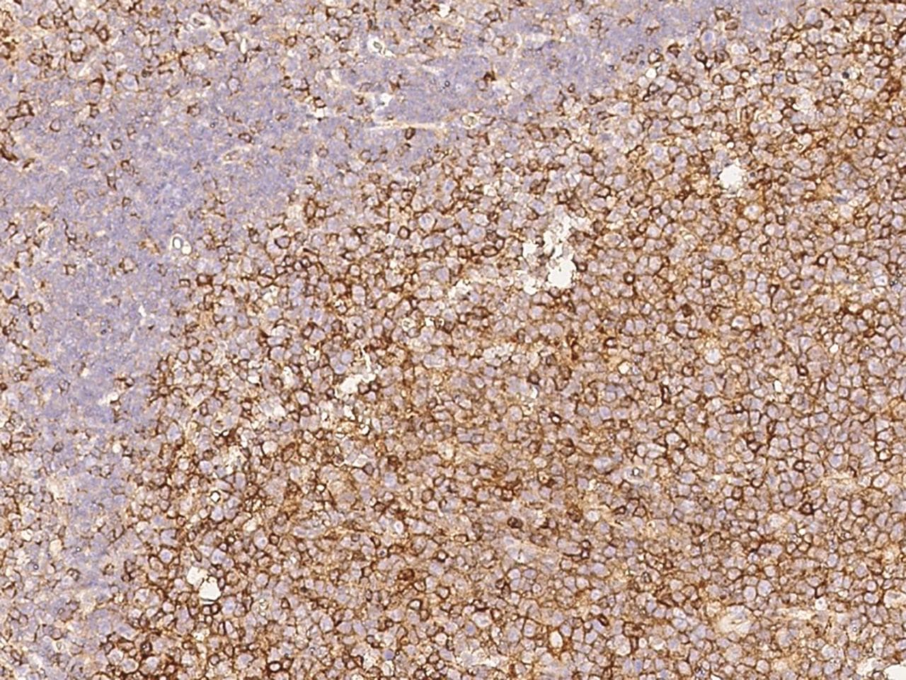 Monoclonal Rabbit anti-Human CD58 Antibody (clone 126, Preservative Free, IHC)