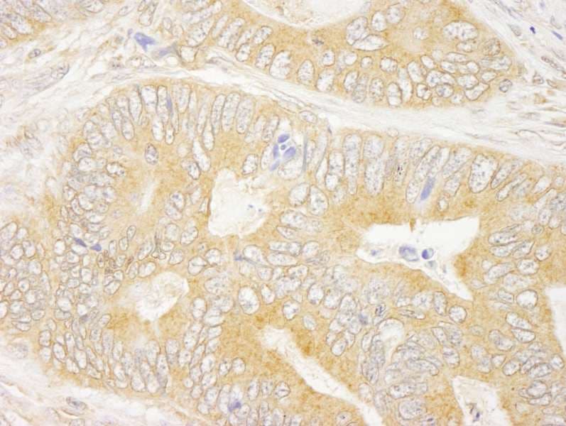 Polyclonal Rabbit anti-Human GRB10 Antibody (aa100-150, IHC)
