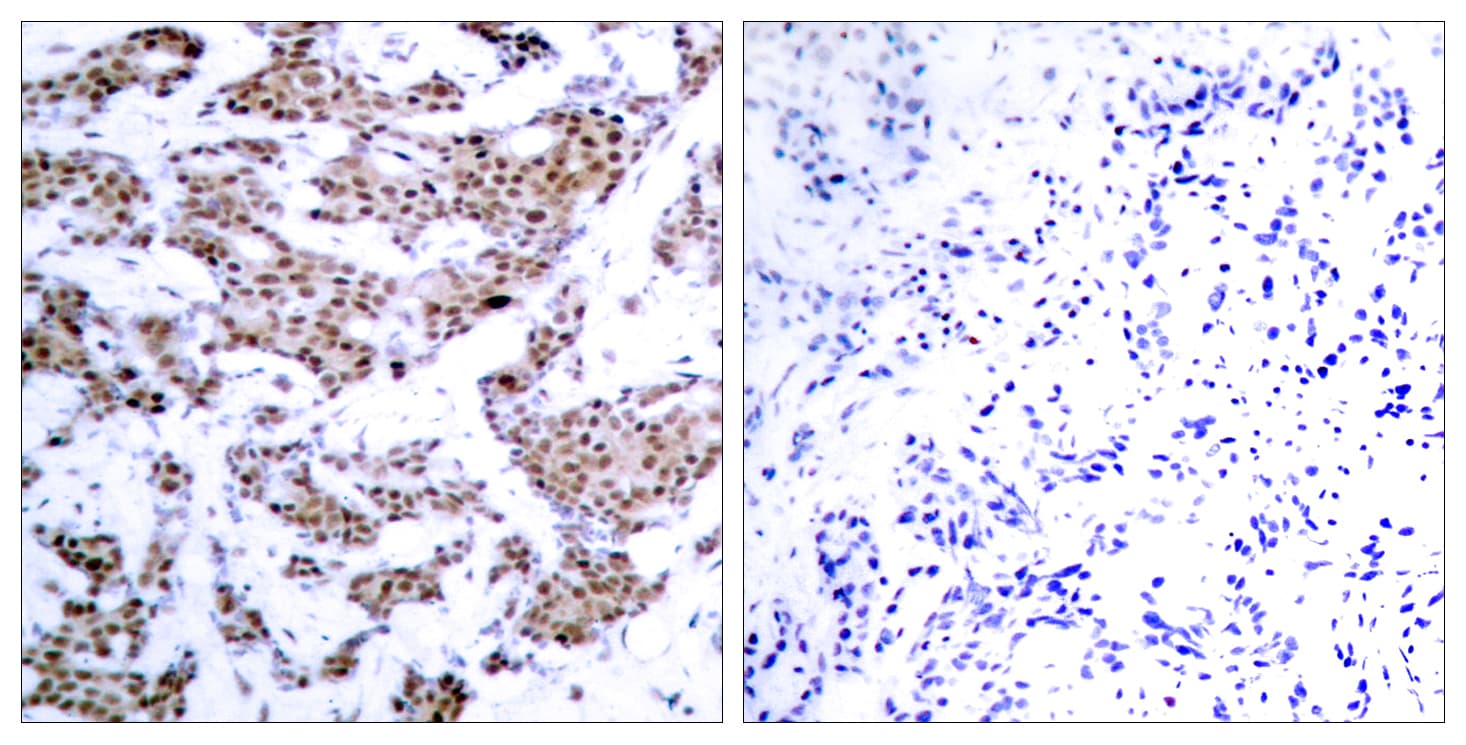 MEF2A / MEF2 Antibody (phospho-Thr312)