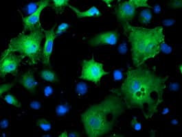 SMS / Spermine Synthase Antibody (clone OTI5F2)