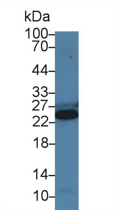 TNNI3 / Cardiac Troponin I Antibody (aa2-211)