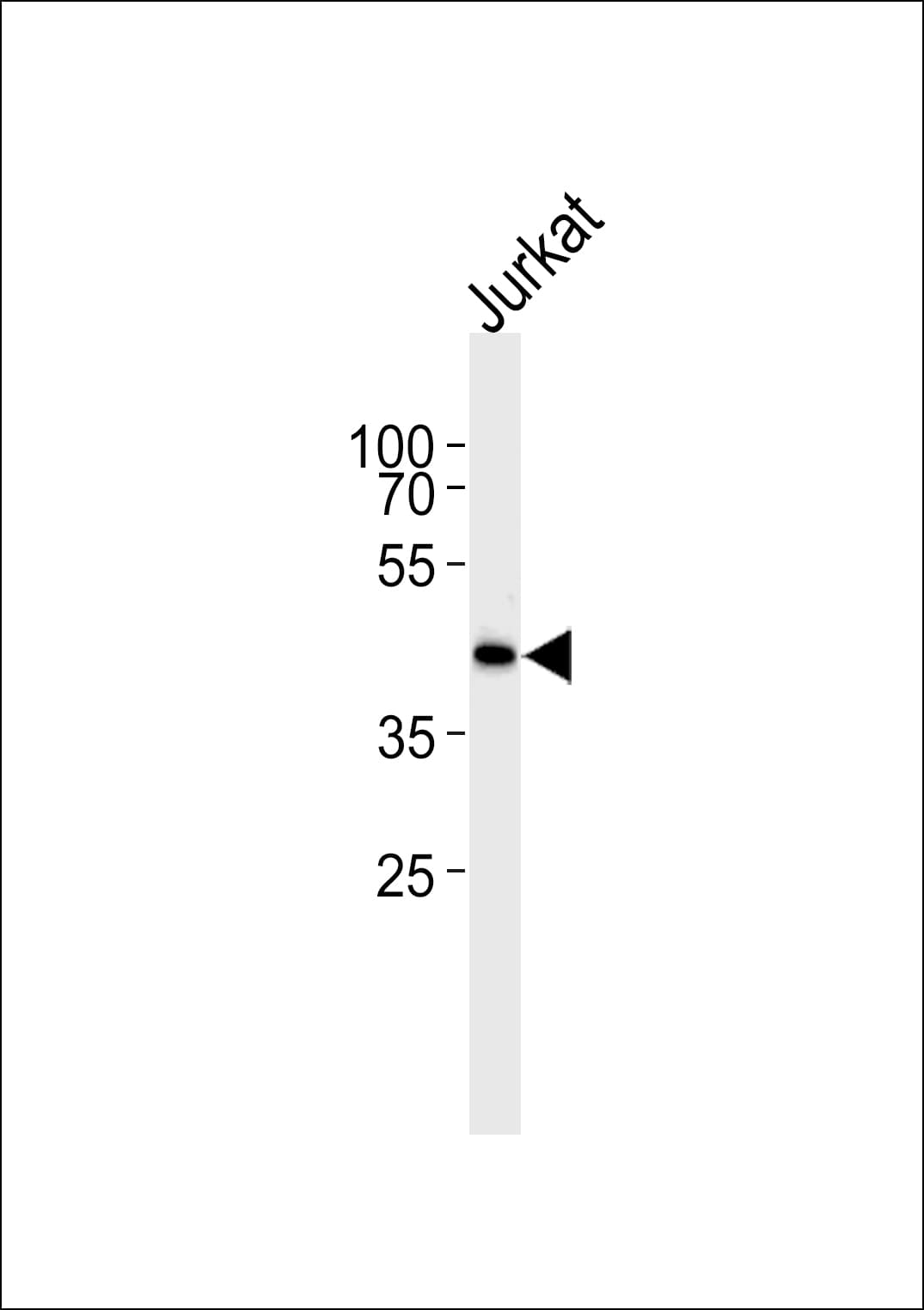 ETS1 / ETS-1 Antibody (aa43-70)