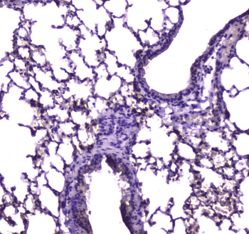 Polyclonal Rabbit anti-Human E-FABP / FABP5 Antibody (IHC, WB)